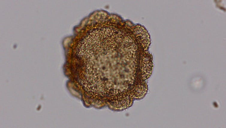 polen microscópico