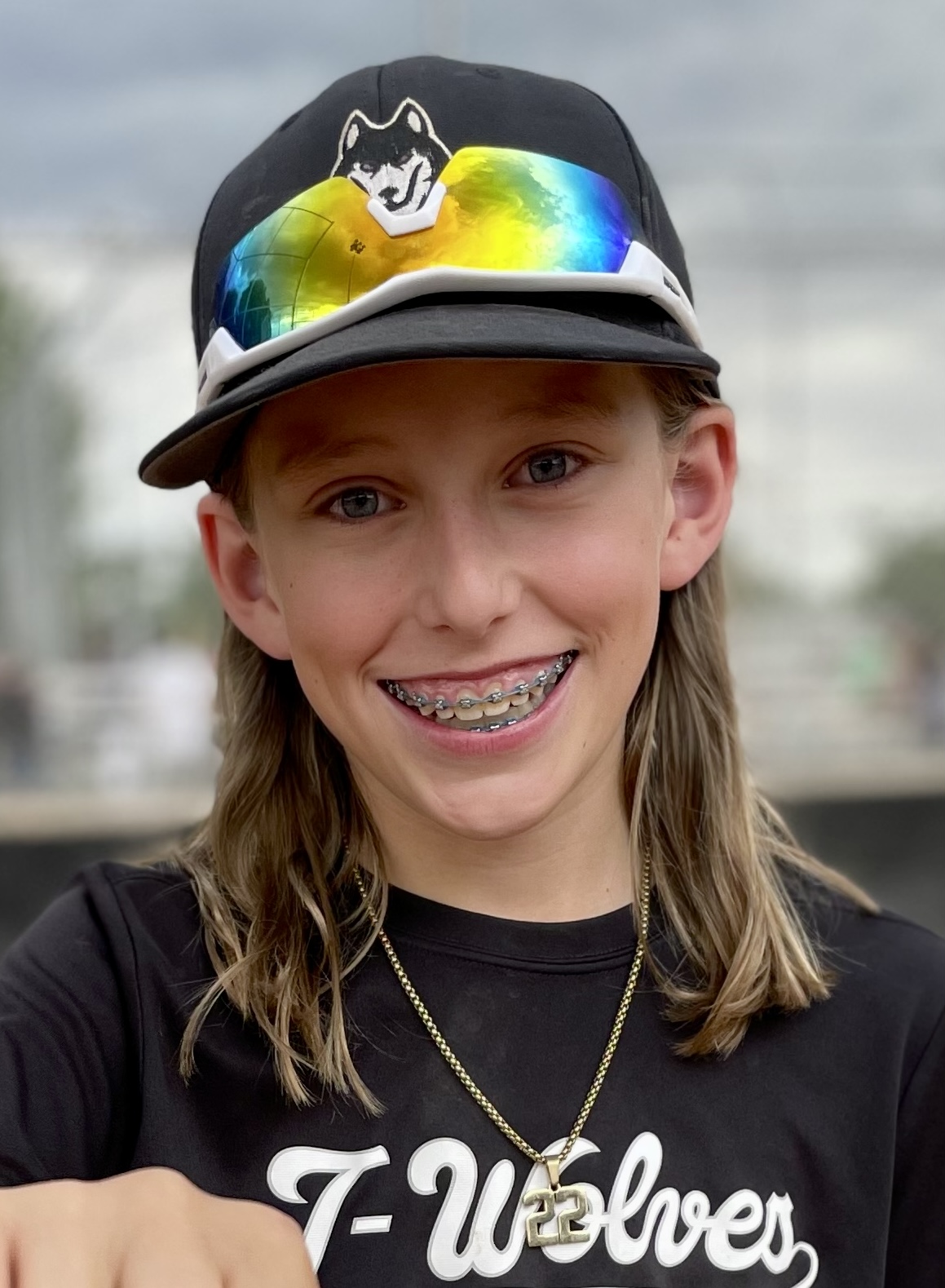 un niño con aparatos ortopédicos y cabello rubio hasta los hombros usa una gorra de béisbol