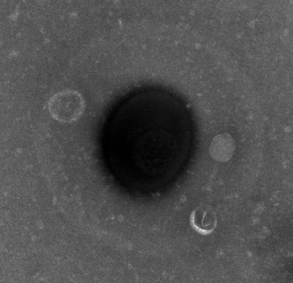 una micrografía electrónica de barrido en blanco y negro que muestra un gran círculo negro con varios círculos pequeños adheridos al exterior
